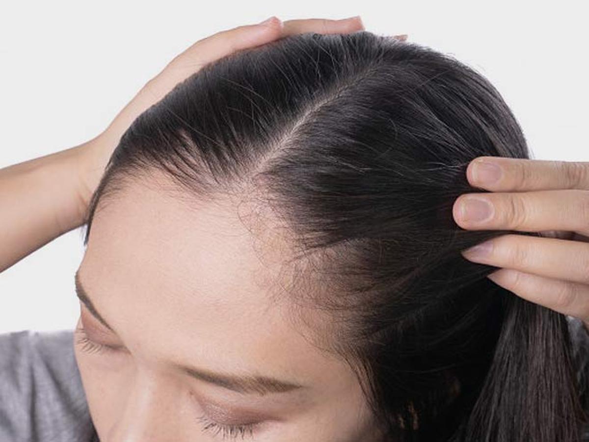 Suffering From Thinning Hair? Try This Homemade Oil | HerZindagi