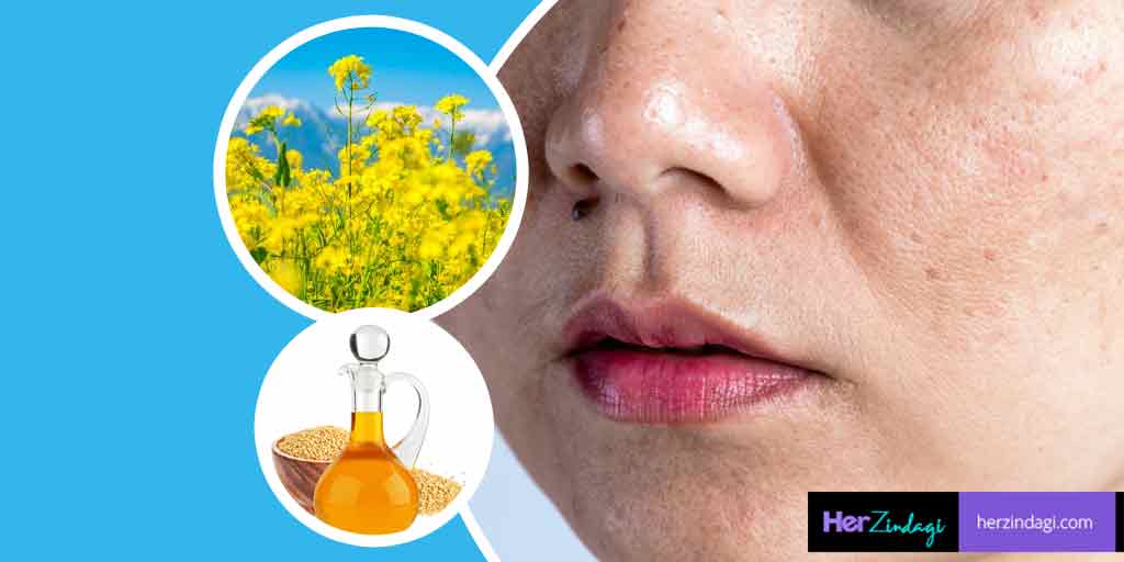 DIY Mustard Oil Face Mask To Get Rid Of Pigmentation & Dark Spots DIY Mustard Oil Face Mask To