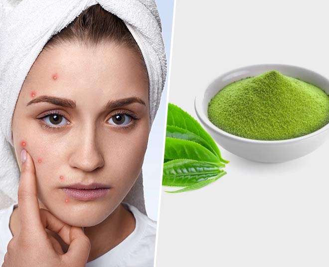 Best Green Tea Gharelu Nuskhe For Acne And Acne Scars best green tea home remedies for acne