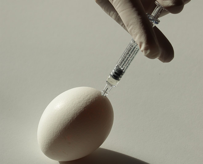 artificial insemination