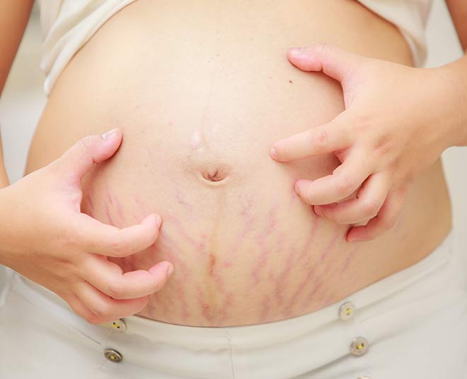 skin-changes-during-pregnancy-itchy-hands-feet-and-abdomen-skin