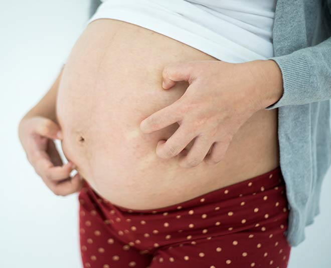 skin changes during pregnancy