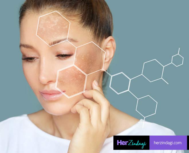 Side Effects, Benefits Of Bleaching Your Face | HerZindagi
