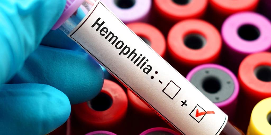 World Haemophilia Day: 10 Facts You Must Know About This Condition