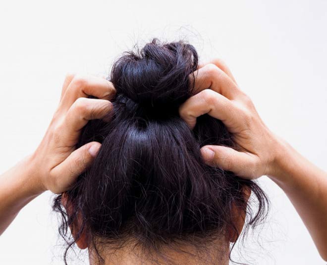 Itchy Scalp Day After Washing Hair Know Reason itchy scalp day after