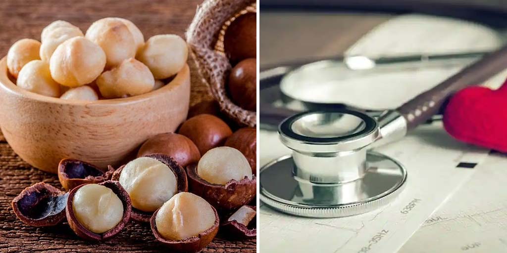 Macadamia Nuts Benefits In Hindi-क्या आप जानते हैं मैकाडामिया नट्स के