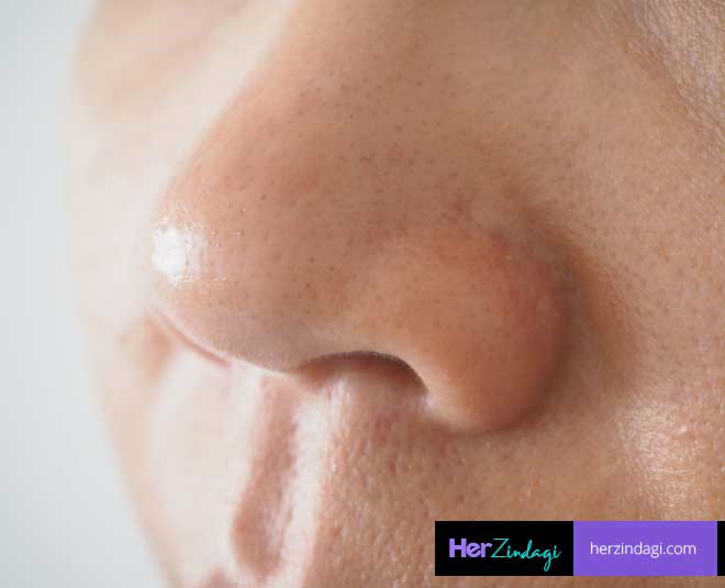 neem beauty clogged pores