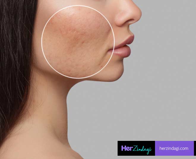 neem beauty products