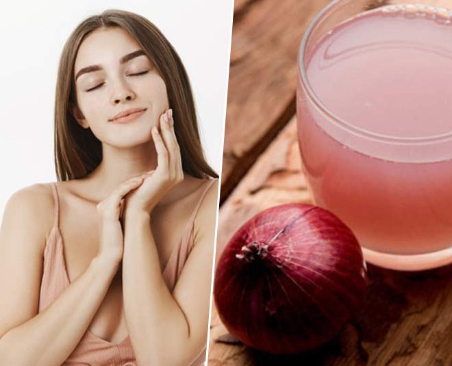 Beauty Benefits of Onion Juice beauty benefits of onion juice