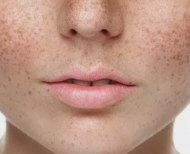 pigmentation duet to these mistakes