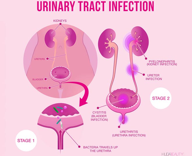 uti presentation in pregnancy