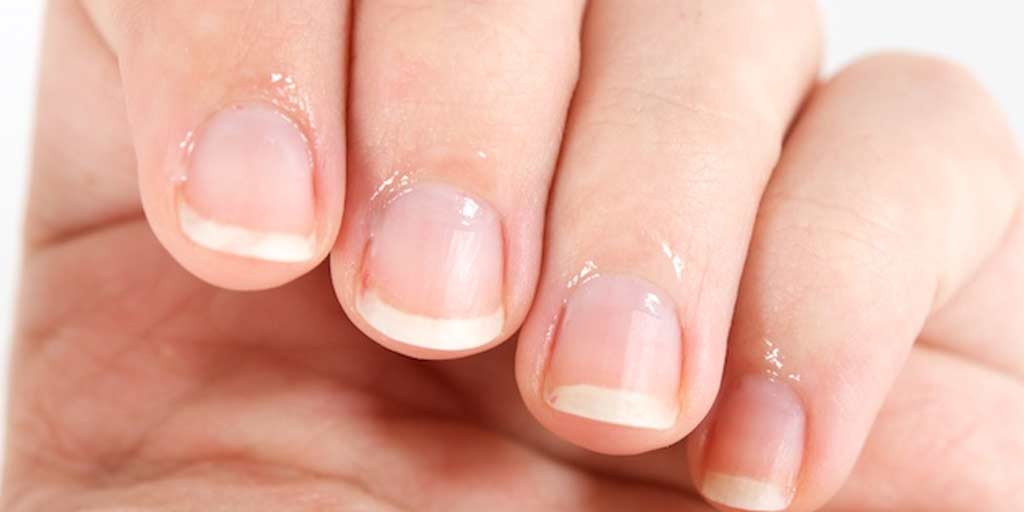 what-causes-tender-nails-some-reasons-and-how-you-can-treat-it-what