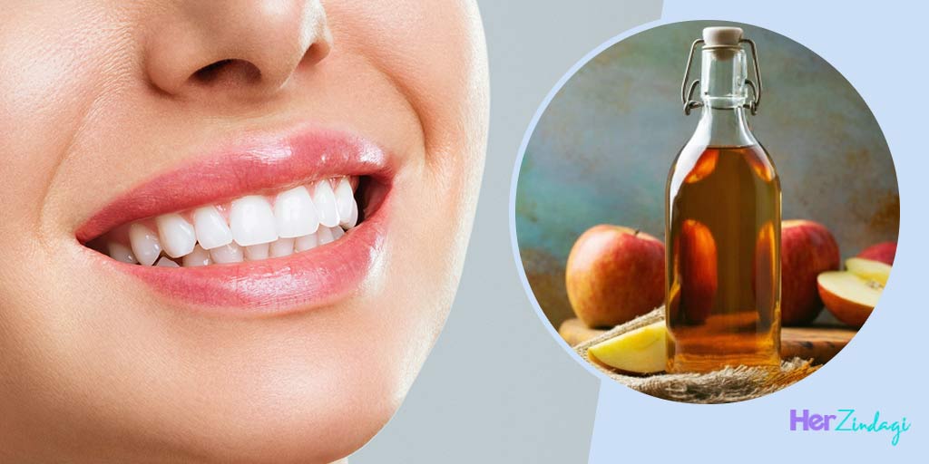 How Do You Use Apple Cider Vinegar For Your Teeth In Hindi दांतों की