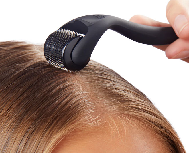Know How You Can Use Derma Roller In The Hair In Hindi know how you