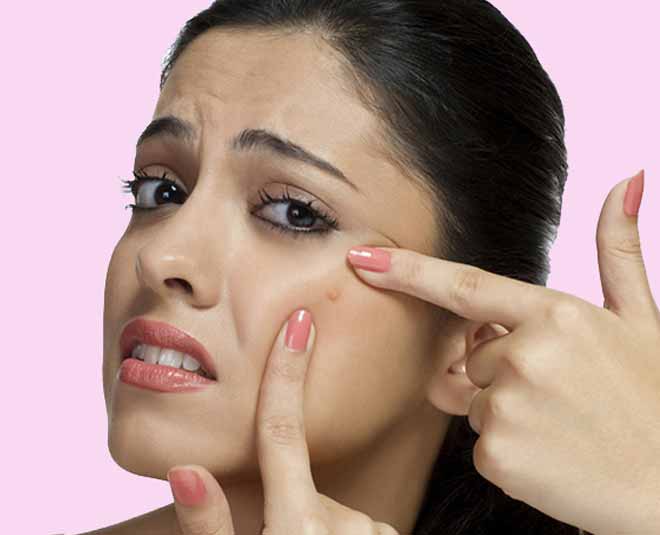ashwagandha for pimples