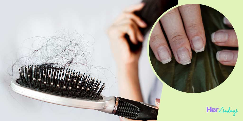 Causes of Hair Loss And Brittle Nails causes of hair loss and brittle nails HerZindagi