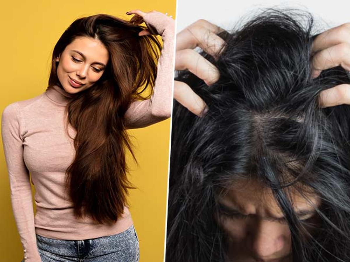 Expert Tips: Morning Hair Care Routine For Oily Hair-ऑयली बालों के लिए  अपनाएं ये 'मॉर्निंग हेयर केयर रूटीन'
