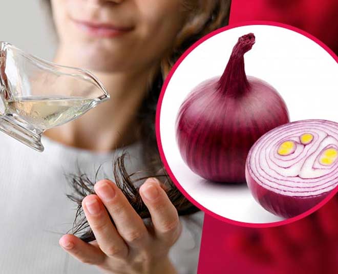 onion for beautiful hair