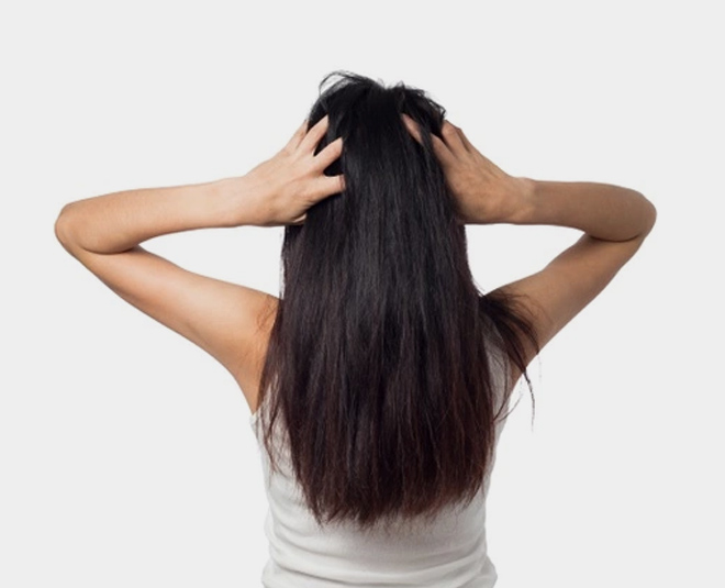 scalp fungal infection by expert