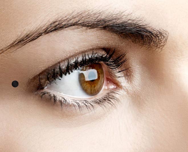 unlucky moles on face around eyes