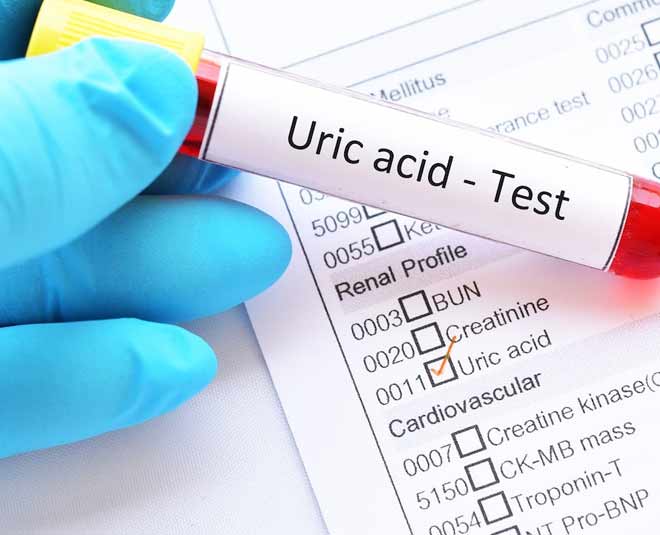 what is uric acid