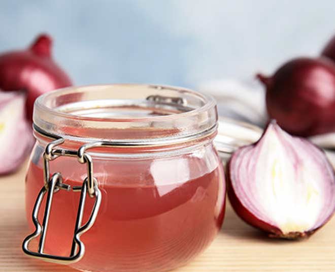 onion juice kadi patta hair mask for dandruff