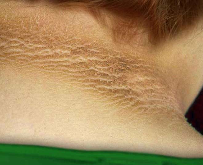 skin condition and issues