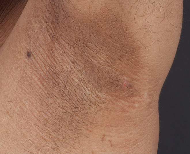 skin condition pigments