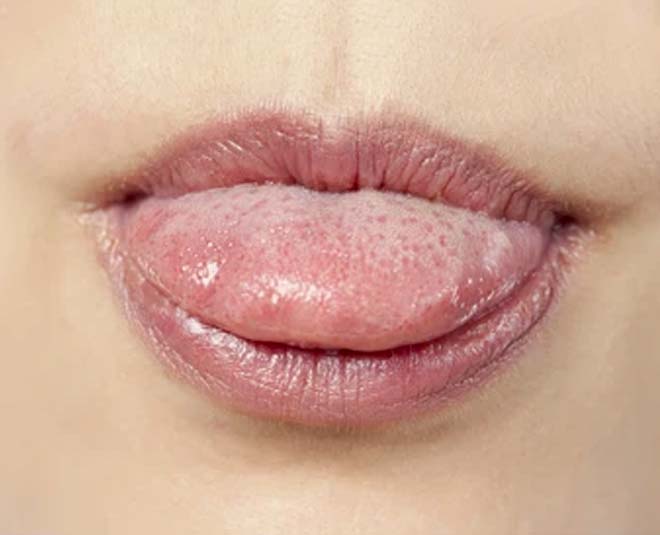 winter lip care routine and tips