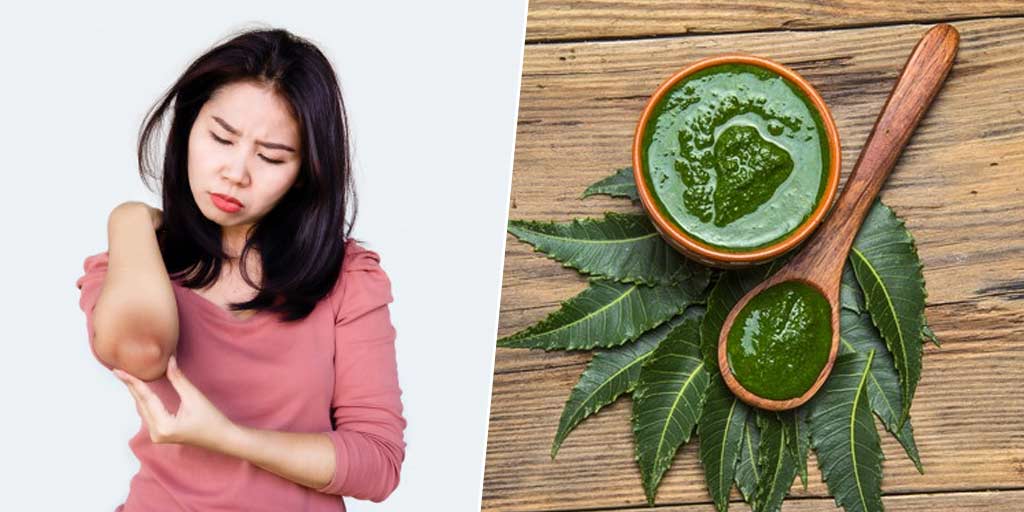 DIY Homemade Curry Leaves Mask To Get Rid Of Dark Elbows And KneesDIY