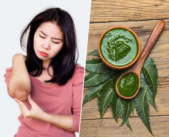 DIY Homemade Curry Leaves Mask To Get Rid Of Dark Elbows And Knees