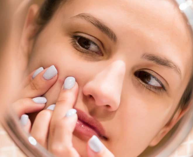 acne around mouth causes