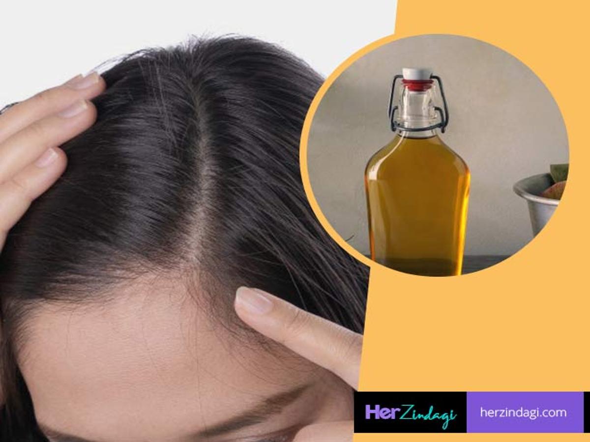DIY Apple Cider Vinegar For Hair Growth | diy apple cider vinegar for hair  growth | HerZindagi