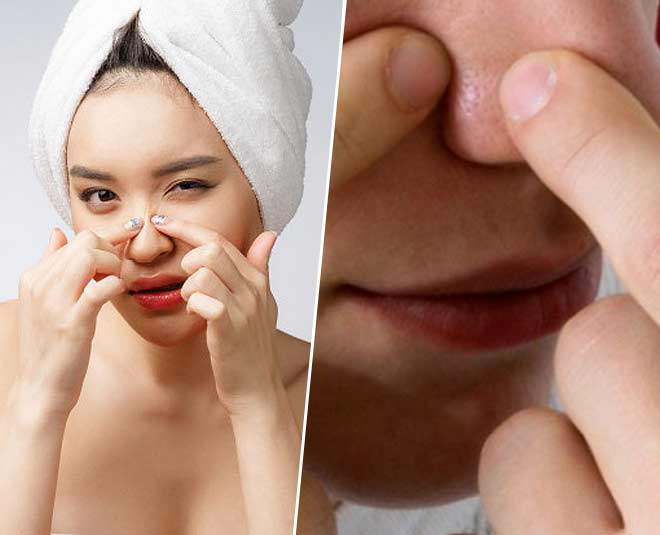gharelu nuskhe for nose acne gharelu nuskhe for nose acne