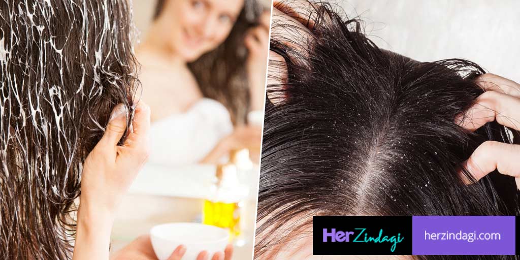 5 Steps Home Hair Spa For Dandruff By Expert | 5 steps home hair spa for  dandruff by expert | HerZindagi