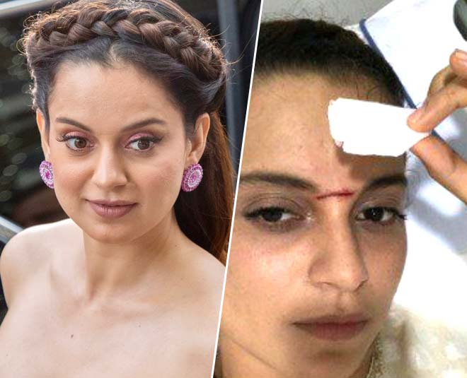 कंगना रनौत kangana ranaut accident