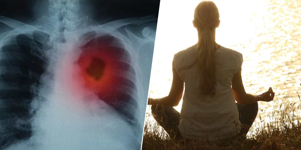 Yoga Asanas To Help Those With Asthma, Lung Cancer By Yoga Expert-Yoga