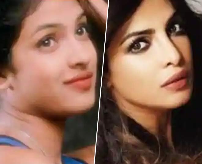 priyanka chopra after surgery