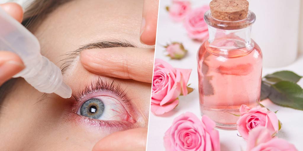Rose Water Benefits For Eyes By Expert Dr. Anureeta WadhawanExpert