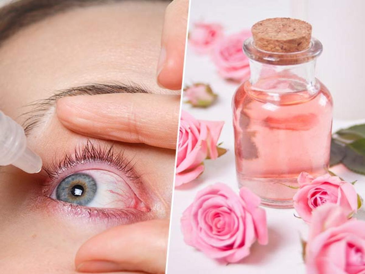 Rose Water Benefits For Eyes By Expert Dr Anureeta Wadhawan