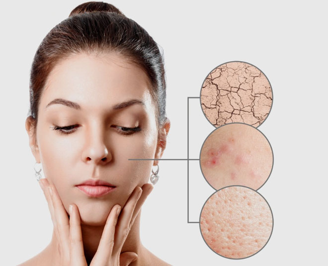 best dry skin pack for winter pigmentation