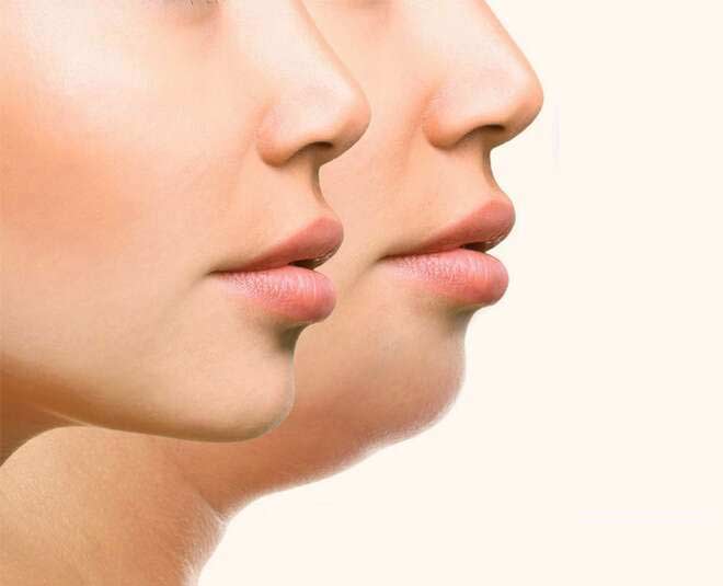 6 ways to get a slimmer face: apart from buccal fat removal, which