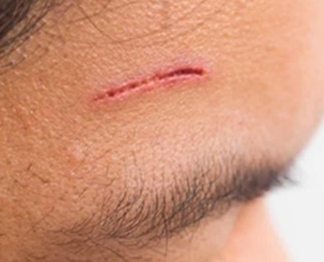 skin injury treatment shahnaz