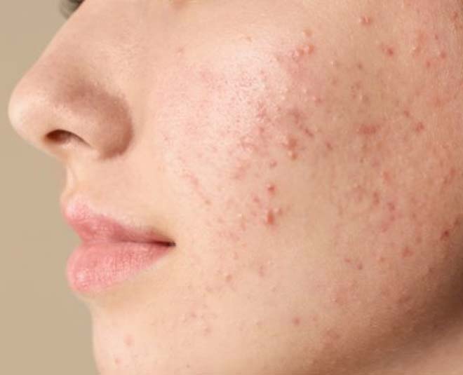 aloe vera skin pores