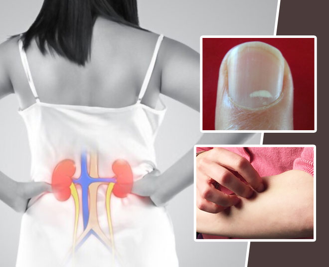 how-to-check-if-kidney-is-functioning-properly-how-to-check-if-kidney