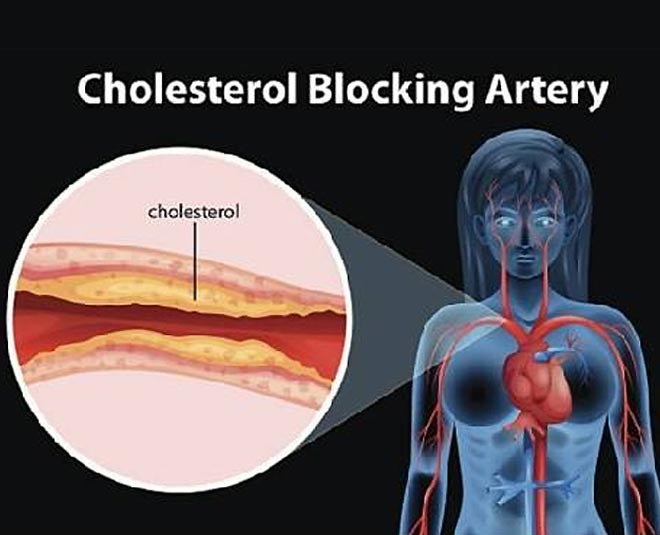 how to control cholesterol and uric acid