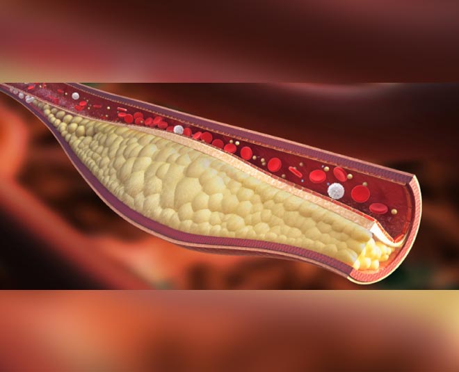 how to control cholesterol without medicine