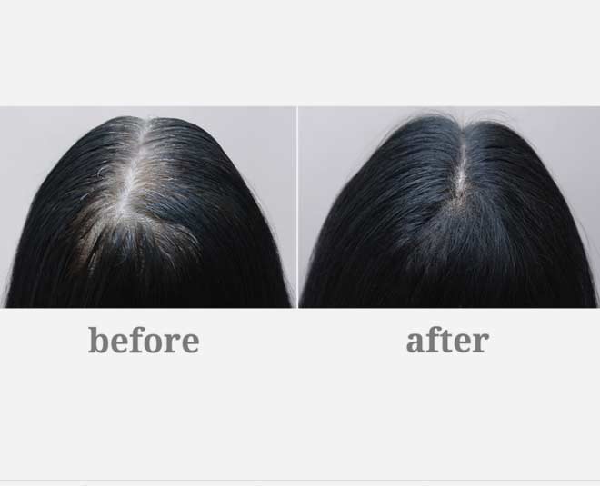Natural Ways To Increase Melanin In Hair For Dark Black Colour | natural ways to increase melanin in hair for dark black colour | HerZindagi Natural Ways To Increase Melanin In Hair For Dark Black Colour | natural ways to increase melanin in hair for dark black colour | HerZindagi