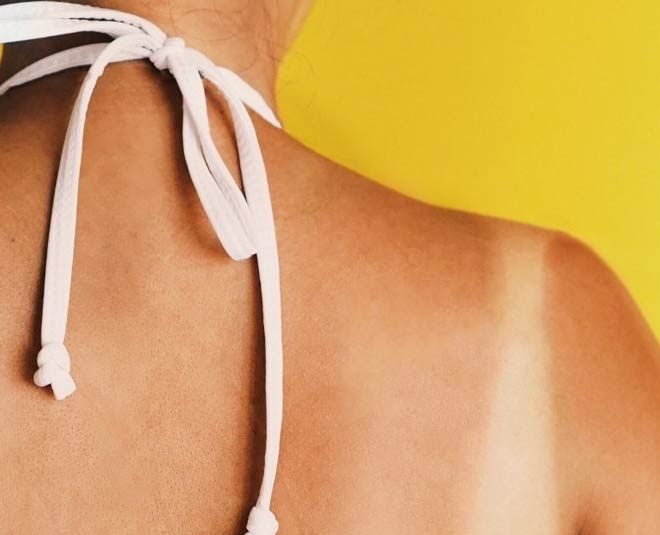 how to remove bra strap marks main