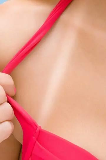 How to Get Rid of Dark Bra Strap Lines on the Shoulder Area